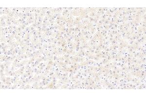 Detection of CALM1 in Human Liver Tissue using Polyclonal Antibody to Calmodulin 1 (CALM1) (Calmodulin 1 anticorps  (AA 1-149))