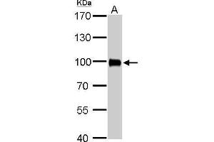 WB Image Villin antibody detects VIL1 protein by Western blot analysis.