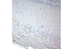 IHC on rat olfactory using Rabbit antibody to rat & mouse OMP (Olfactory Marker Protein): IgG  at a concentration of 20 µg/ml in paraffin embeded section. (OMP anticorps)