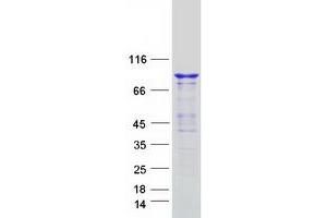 Validation with Western Blot