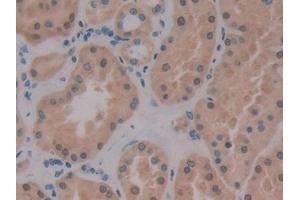 Detection of PKIb in Human Kidney Tissue using Polyclonal Antibody to Protein Kinase Inhibitor Beta (PKIb)