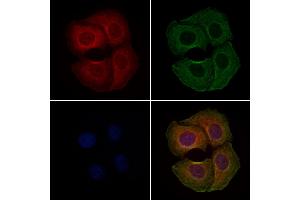 ABIN6262067 and ABIN6279097 staining Hela cells by IF/ICC. (GPT2 anticorps  (Internal Region))