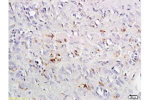Formalin-fixed and paraffin embedded rat exfoliated cells tissue labeled with Anti-CCR4 Polyclonal Antibody, Unconjugated (ABIN738666) at 1:200 followed by conjugation to the secondary antibody and DAB staining (CCR4 anticorps  (AA 201-300))