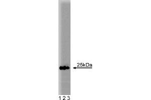 Western Blotting (WB) image for anti-RAB5A, Member RAS Oncogene Family (RAB5A) (AA 1-215) antibody (ABIN968139)