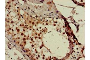 Immunohistochemistry of paraffin-embedded human testis tissue using ABIN7171024 at dilution of 1:100