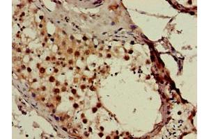 Immunohistochemistry of paraffin-embedded human testis tissue using ABIN7171024 at dilution of 1:100 (SMN1 anticorps  (AA 3-194))
