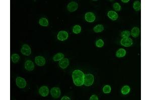 anti-Nucleoprotein TPR (TPR) (N-Term) antibody