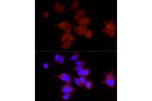 Immunofluorescence analysis of MCF-7 using FA/PIEZO1 antibody (ABIN6133207, ABIN6145612, ABIN6145613 and ABIN6220594) at dilution of 1:100 (40x lens).