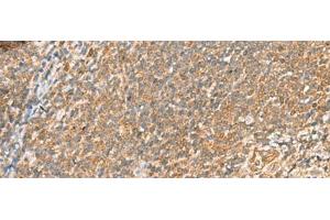 Immunohistochemistry of paraffin-embedded Human tonsil tissue using SCRN2 Polyclonal Antibody at dilution of 1:60(x200)