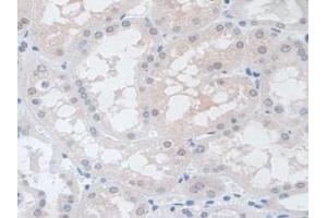 IHC-P analysis of Human Kidney Tissue, with DAB staining. (VCP anticorps  (AA 125-371))