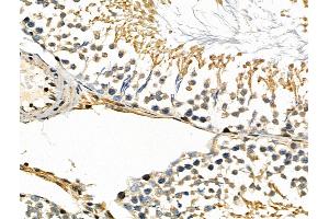 ABIN6257420 and ABIN6275854 at 1/100 staining Rat testis tissue by IHC-P. (PKN1 anticorps  (Internal Region))