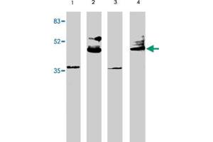 Western blot analysis using VSX2 polyclonal antibody at 1 ug/mL on rat liver (lane 1), retina tissue lysate (lane 2), mouse liver (lane 3) and retina (lane 4) tissue lysate. (VSX2 anticorps  (AA 264-361))