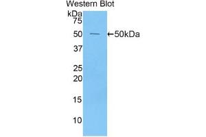 Western blot analysis of the recombinant protein. (Peroxiredoxin 1 anticorps  (AA 1-199))