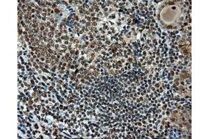 Immunohistochemical staining of paraffin-embedded Kidney tissue using anti-RC211175 mouse monoclonal antibody. (TUBA8 anticorps)