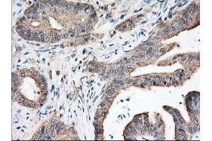 Immunohistochemistry (IHC) image for anti-Nucleoredoxin-Like 2 (NXNL2) antibody (ABIN1499887) (NXNL2 anticorps)