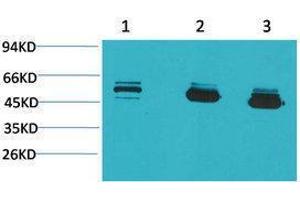 Western Blotting (WB) image for anti-Mitochondrial Calcium Uptake 1 (MICU1) antibody (ABIN3179096) (MICU1 anticorps)