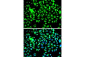 Immunofluorescence (IF) image for anti-Heat Shock 22kDa Protein 8 (HSPB8) (AA 1-196) antibody (ABIN3016167)