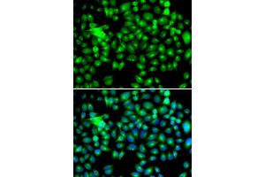 Immunofluorescence (IF) image for anti-Heat Shock 22kDa Protein 8 (HSPB8) (AA 1-196) antibody (ABIN3016167) (HSPB8 anticorps  (AA 1-196))
