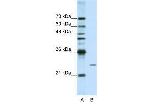WB Suggested Anti-POP4 Antibody Titration:  1. (RPP29 anticorps  (C-Term))