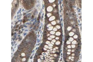 Caspase 3 Antibody for IHC in human colon tissue