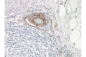 Image no. 1 for anti-Nerve Growth Factor (NGF) antibody (ABIN465644)