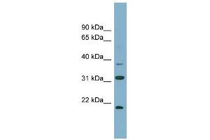 WB Suggested Anti-N6AMT1 Antibody Titration:  0. (N6AMT1 anticorps  (N-Term))