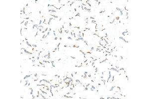 Immunocytochemistry (ICC) image for anti-Mitochondrial Calcium Uniporter (MCU) (AA 300-350) antibody (ABIN7795789)