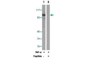 Western blot analysis of extracts from HeLa cells, treated with TNF-a (20 ng/mL, 30 mins), using PLA2G4A polyclonal antibody .