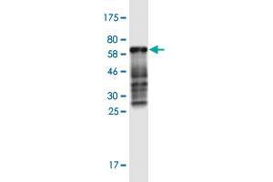 Western Blot detection against Immunogen (60.