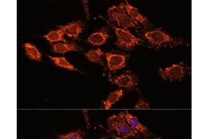 Immunofluorescence analysis of C6 cells using PASK Polyclonal Antibody at dilution of 1:100. (PASK anticorps)