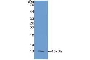 Detection of Recombinant S100A12, Human using Monoclonal Antibody to S100 Calcium Binding Protein A12 (S100A12)