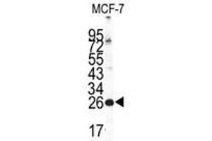 Image no. 1 for anti-Neuronal Calcium Sensor 1 (NCS1) (Center) antibody (ABIN357105) (NCS1 anticorps  (Center))
