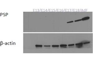 Western Blotting (WB) image for anti-Syntaxin Binding Protein 3 (STXBP3) (AA 146-160), (Internal Region) antibody (ABIN1108779) (STXBP3 anticorps  (Internal Region))