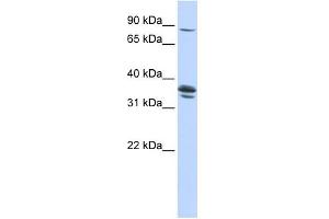 SLCO3A1 antibody used at 1 ug/ml to detect target protein.