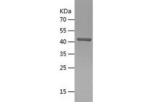 Western Blotting (WB) image for ClpP Caseinolytic Peptidase, ATP-Dependent, Proteolytic Subunit Homolog (E. Coli) (CLPP) (AA 66-277) protein (His-IF2DI Tag) (ABIN7122409)