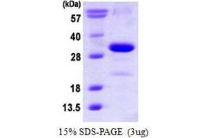 SDS-PAGE (SDS) image for Cyclin-Dependent Kinase Inhibitor 1B (p27, Kip1) (CDKN1B) (AA 1-198) protein (His tag) (ABIN667591)