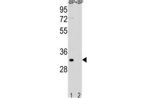Western Blotting (WB) image for anti-Family with Sequence Similarity 26, Member F (FAM26F) antibody (ABIN3004478) (FAM26F anticorps)