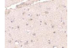 Immunohistochemistry of BRCC36 in human brain tissue with BRCC36 antibody at 2.