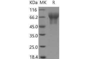 Western Blotting (WB) image for Cell Adhesion Molecule 1 (CADM1) (AA 1-377) protein (His tag) (ABIN7195011)