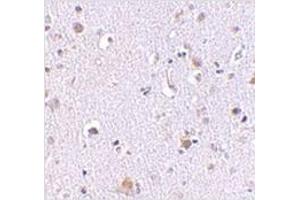 anti-Nucleoporin 160kDa (NUP160) (C-Term) antibody