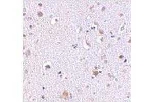 Immunohistochemistry of NUP160 in human brain tissue with NUP160 antibody at 2. (NUP160 anticorps  (C-Term))