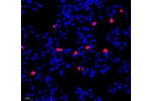 Immunofluorescence of paraffin embedded mouse lung using IL-23R (ABIN7074355) at dilution of 1:200 (400x lens)
