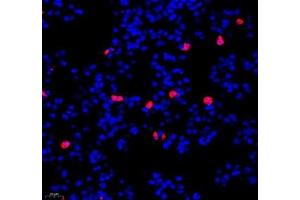 Immunofluorescence of paraffin embedded mouse lung using IL-23R (ABIN7074355) at dilution of 1:200 (400x lens) (IL23R anticorps)