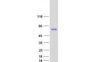Validation with Western Blot