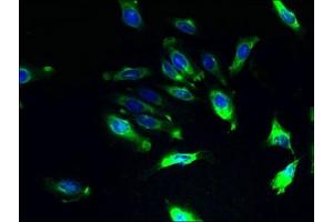 Immunofluorescent analysis of Hela cells using ABIN7142940 at dilution of 1:100 and Alexa Fluor 488-congugated AffiniPure Goat Anti-Rabbit IgG(H+L) (ILVBL anticorps  (AA 45-344))