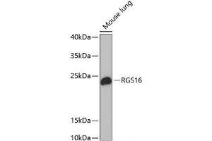 Western blot analysis of extracts of Mouse lung using RGS16 Polyclonal Antibody at dilution of 1:1000. (RGS16 anticorps)