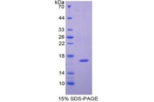 Adenylyl Cyclase Associated Protein 2 (CAP2) ELISA Kit