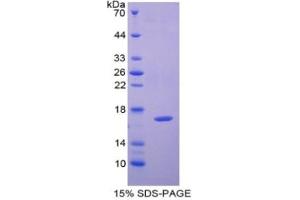 SDS-PAGE of Protein Standard from the Kit (Highly purified E. (CAP2 Kit ELISA)