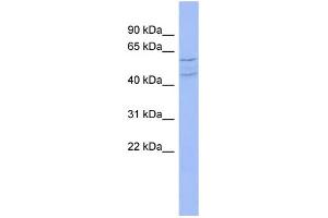 WB Suggested Anti-TWF1 Antibody Titration: 0. (TWF1 anticorps  (N-Term))