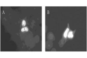 Image no. 1 for anti-Dual-Specificity tyrosine-(Y)-phosphorylation Regulated Kinase 1A (DYRK1A) (AA 486-763) antibody (ABIN297140) (DYRK1A anticorps  (AA 486-763))